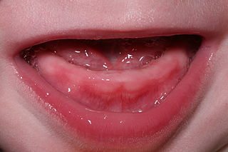Your baby's goobery, soon-to-be-chompy mouth, with a tooth breaking through in the middle
