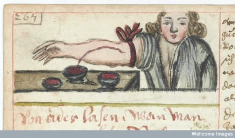 Bloodletting: a good reason to discard disproven therapies
